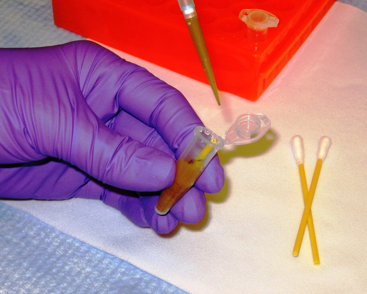 Semaglutide a Cosa Serve? Guida Completa alla Ricerca 1 Semaglutide a cosa serve: ricerca metabolica in laboratorio con purezza HPLC